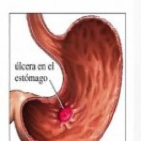 Bruscamente cè stato dolore del collo