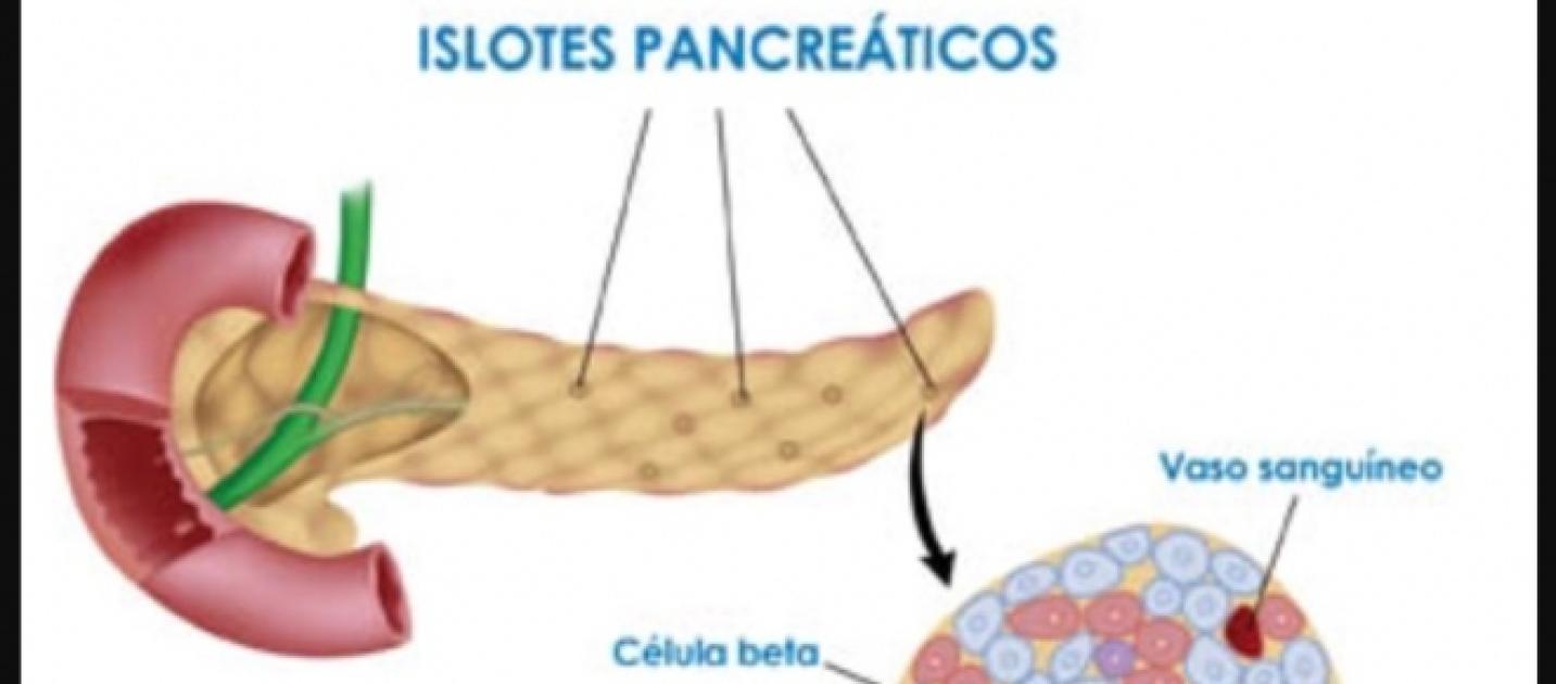 NUEVO AVANCE PARA LA DIABETES TIPO 1 NUEVO AVANCE PARA LA DIABETES TIPO 1