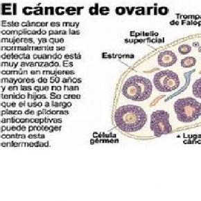 Un tratamiento para el cáncer de ovario
