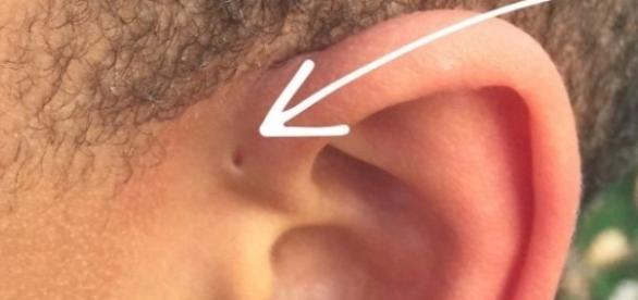 Posti sulla faccia allatto di trattamento di donne incinto