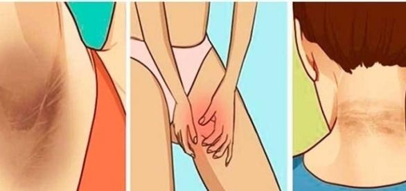 Dicas para acabar com manchas na pele